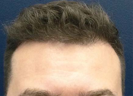 After Photo