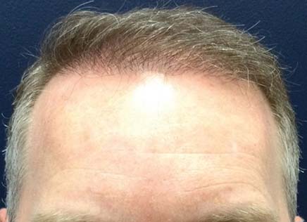 After Photo