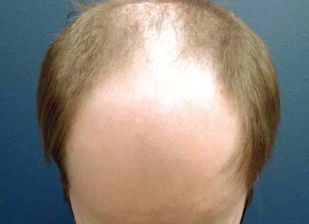 Before Photo