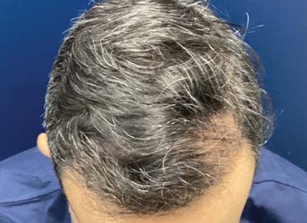 After Photo