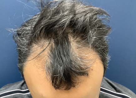 Before Photo